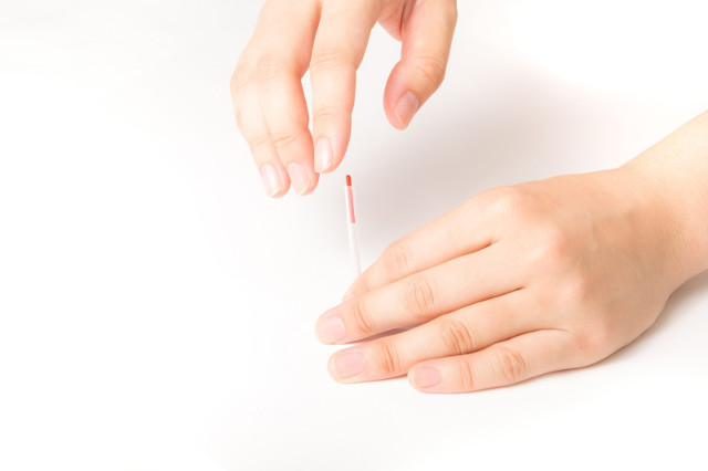 尼崎でスポーツ障害・腰痛の相談をするなら【とみひさ鍼灸院整骨院】へ